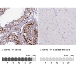 C19orf57 Antibody, Novus Biologicals 0.1mL; Unlabeled:Antibodies, Polyclonal
